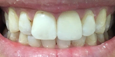 After image