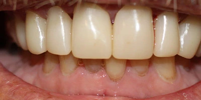 After image