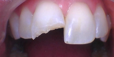 Before image