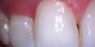 After image