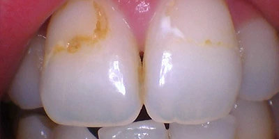 Before image
