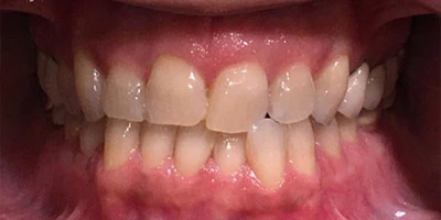 Before image