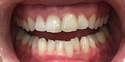 Before image