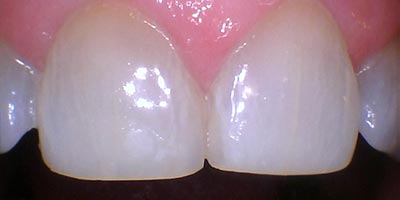 After image