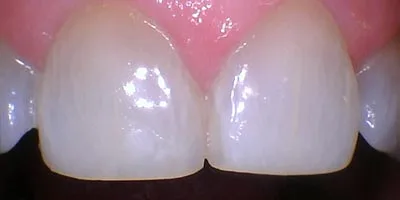 After image