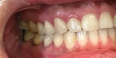 After image