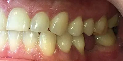 After image