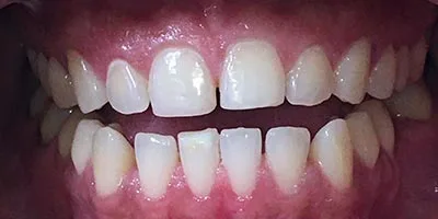 Before image
