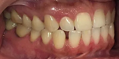 Before image