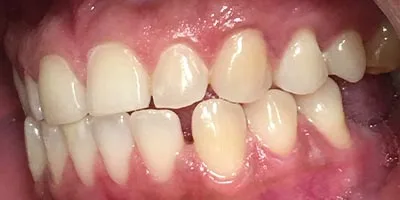 Before image