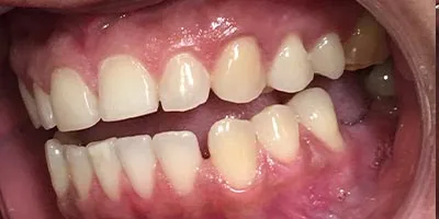 Before image