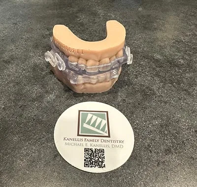 Custom Sleep Apnea Appliance
