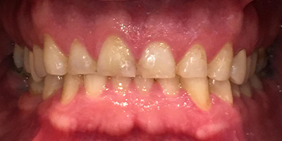 Before image